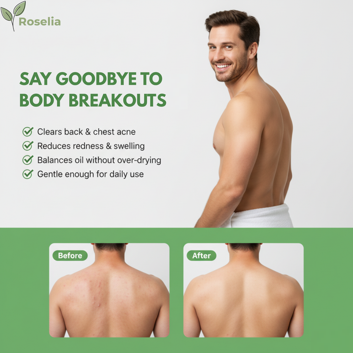 Roselia™ Antifungal Soap