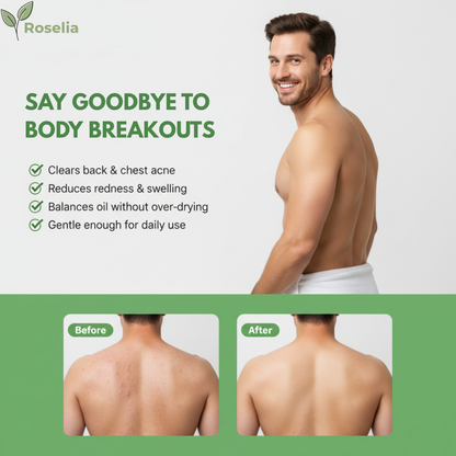 Roselia™ Antifungal Soap