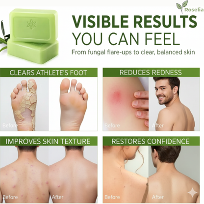 Roselia™ Antifungal Soap