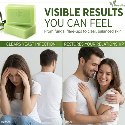 Roselia™ Antifungal Soap